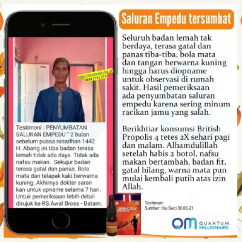 manfaat-british-propolis-mengobati-batu-empedu