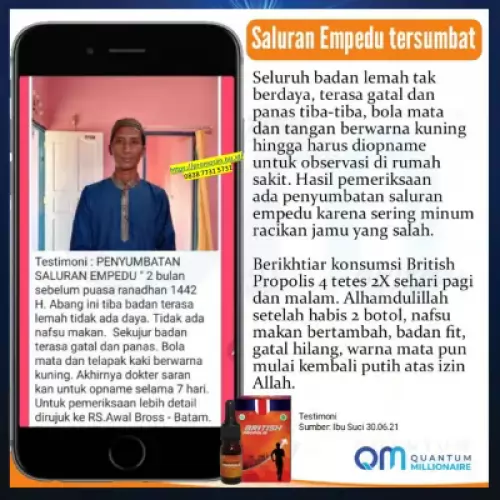 manfaat-british-propolis-mengatasi-batu-empedu