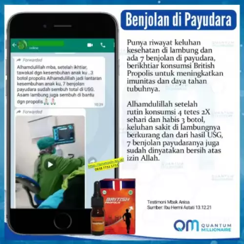 manfaat-british-propolis-menyembuhkan-benjolan-payudara