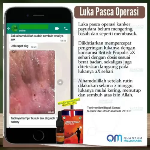 testimoni-british-propolis-mengobati-benjolan-payudara