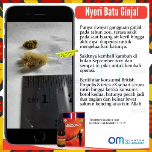 testimoni-british-propolis-mengatasi-gagal-ginjal