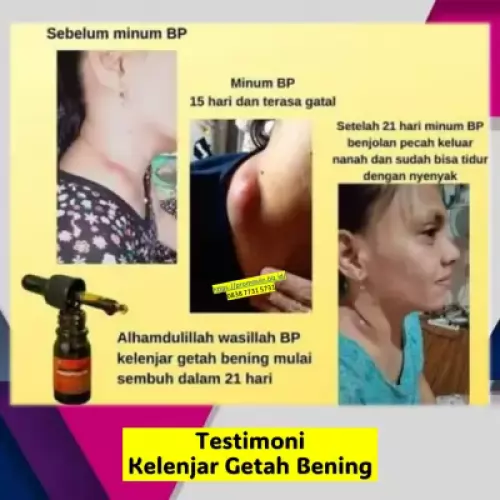 manfaat-british-propolis-menyembuhkan-kelenjar-getah-bening