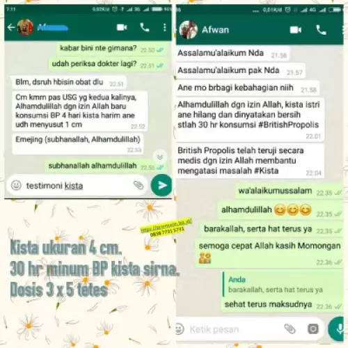 manfaat-british-propolis-mengatasi-kista-miom