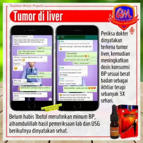 testimoni-british-propolis-mengatasi-liver