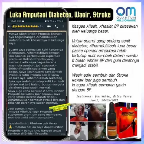 testimoni-british-propolis-mengatasi-wasir